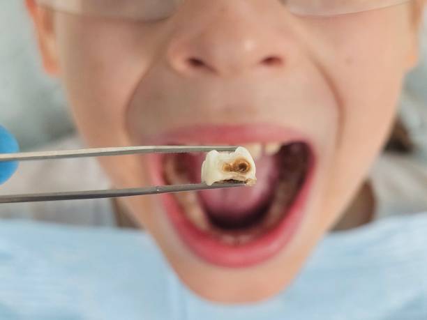 Best Emergency Denture Repair in Norton, KS